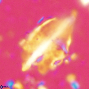 Diplotsekouri musamusbahii VR 026913