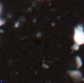 Diplotsekouri indianica 27888
