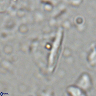 Diplotsekouri indianica 27891