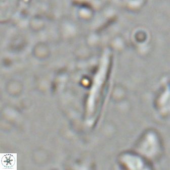 Diplotsekouri indianica 27891