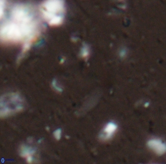 Diplotsekouri francisjosephii 27933