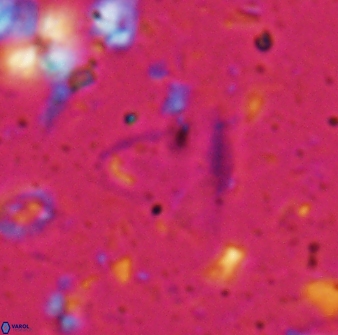Diplotsekouri francisjosephii 27932