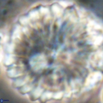 Discoaster multiradiatus 21425