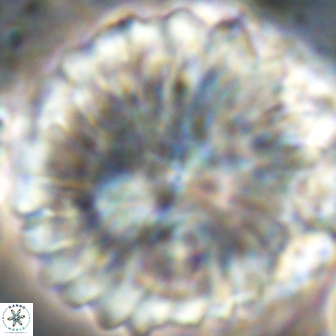 Discoaster multiradiatus 21425