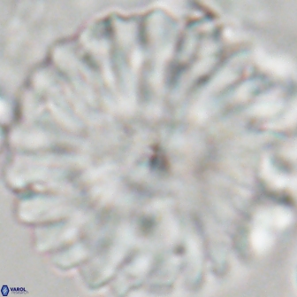 Discoaster multiradiatus 21426
