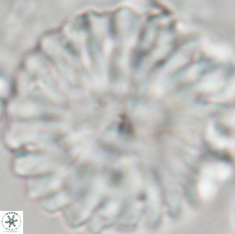 Discoaster multiradiatus 21426