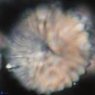 Discoaster multiradiatus 21429