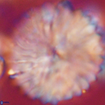 Discoaster multiradiatus 21430