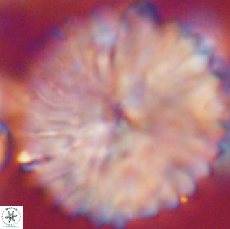 Discoaster multiradiatus 21430