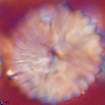 Discoaster multiradiatus 21432