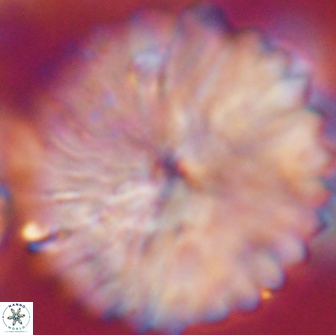 Discoaster multiradiatus 21432