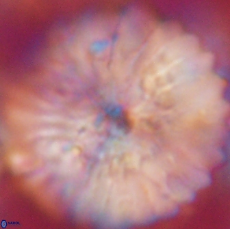 Discoaster multiradiatus 21433