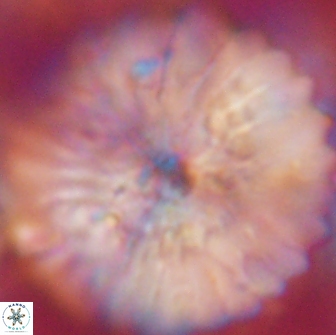Discoaster multiradiatus 21433