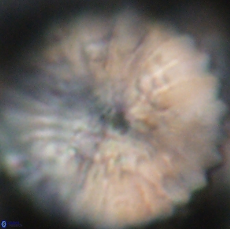 Discoaster multiradiatus 21434