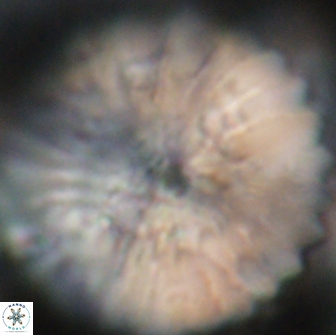Discoaster multiradiatus 21434