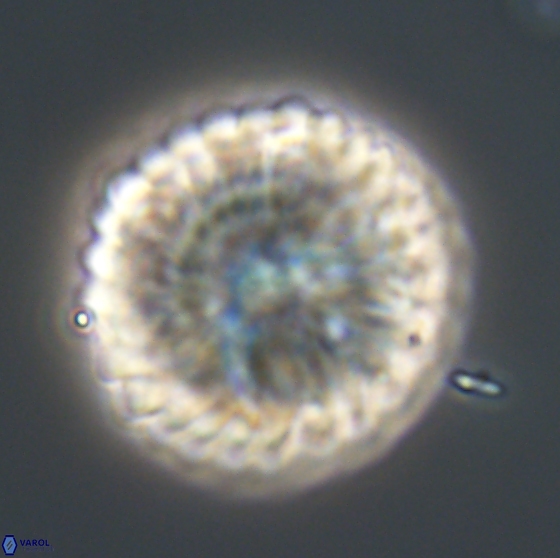 Discoaster multiradiatus 21334