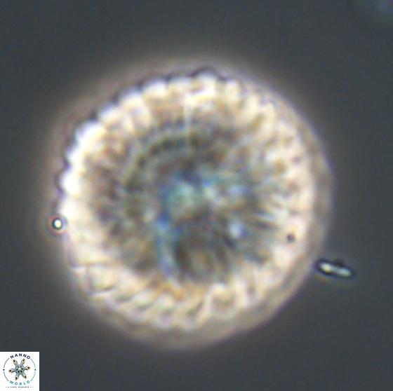 Discoaster multiradiatus 21334