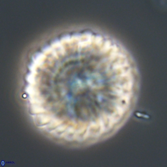 Discoaster multiradiatus 21335