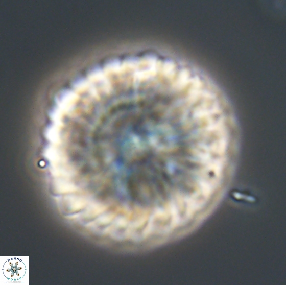 Discoaster multiradiatus 21335