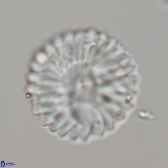 Discoaster multiradiatus 21336