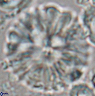 Discoaster multiradiatus 22466