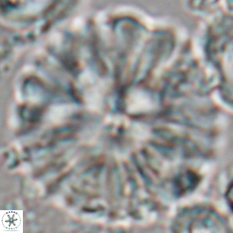 Discoaster multiradiatus 22466