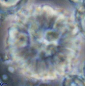 Discoaster multiradiatus 22467