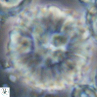 Discoaster multiradiatus 22467