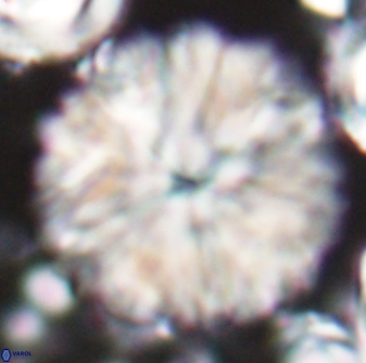 Discoaster multiradiatus 22468