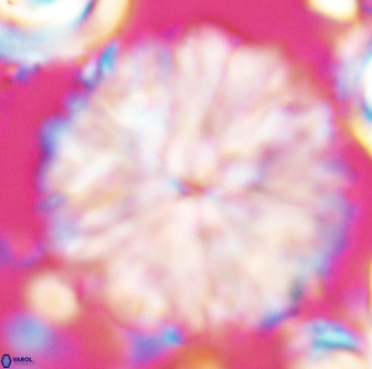 Discoaster multiradiatus 22469