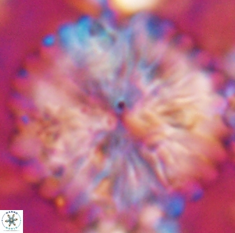 Discoaster multiradiatus 22471