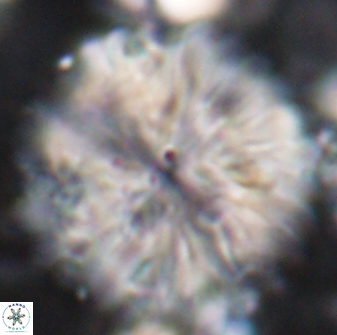 Discoaster multiradiatus 22472