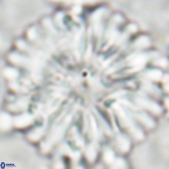 Discoaster multiradiatus 22473