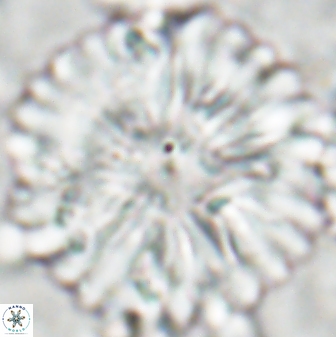 Discoaster multiradiatus 22473