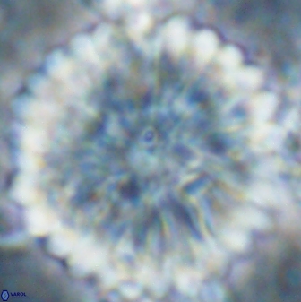 Discoaster multiradiatus 22474
