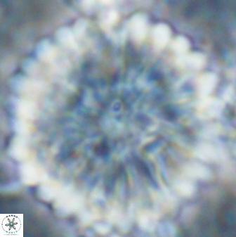 Discoaster multiradiatus 22474