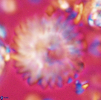 Discoaster multiradiatus 22570