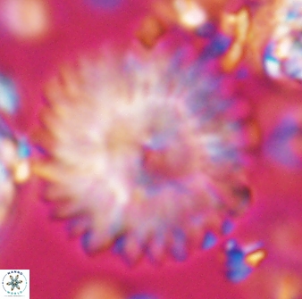 Discoaster multiradiatus 22570