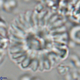 Discoaster multiradiatus 22571