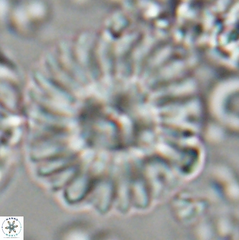Discoaster multiradiatus 22571