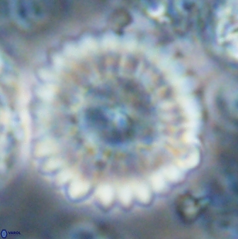 Discoaster multiradiatus 22572
