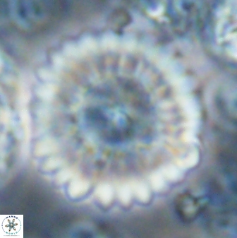 Discoaster multiradiatus 22572
