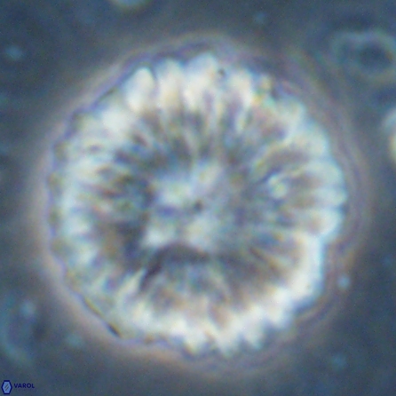 Discoaster multiradiatus 43405