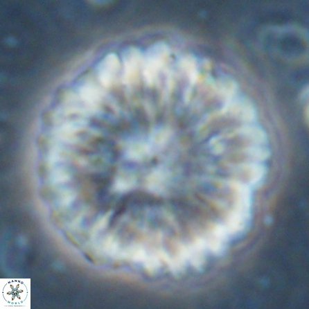 Discoaster multiradiatus 43405