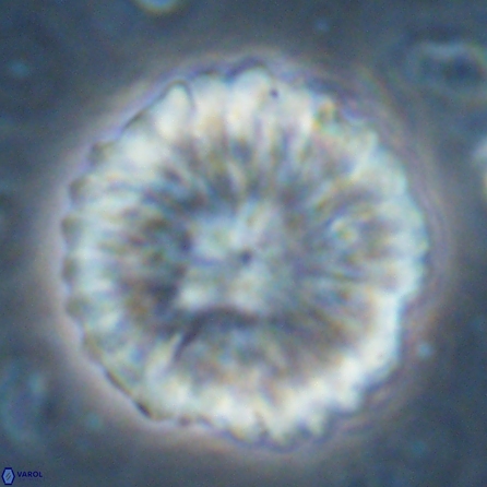 Discoaster multiradiatus 43406