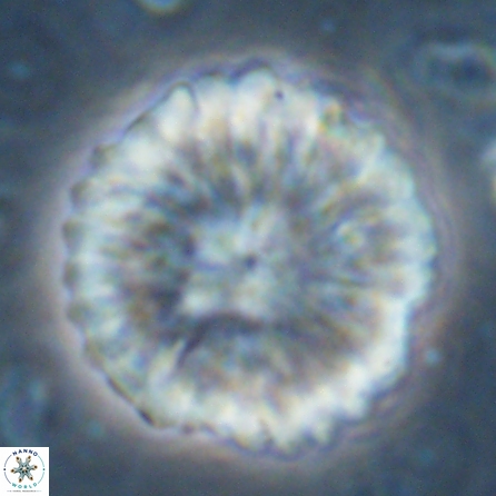 Discoaster multiradiatus 43406