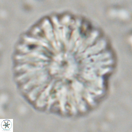 Discoaster multiradiatus 43407