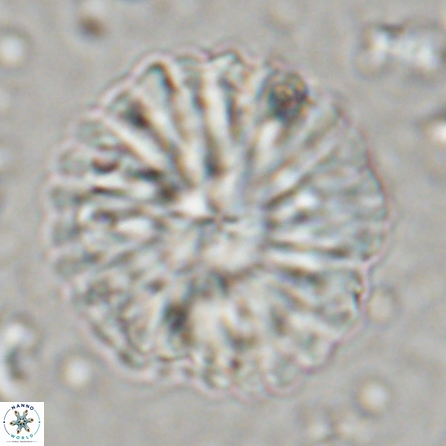 Discoaster multiradiatus 43408