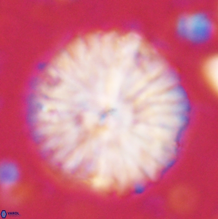 Discoaster multiradiatus 43409