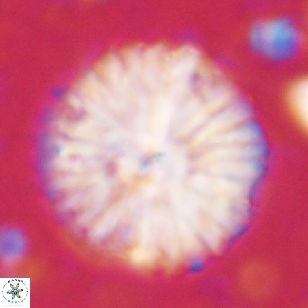 Discoaster multiradiatus 43409